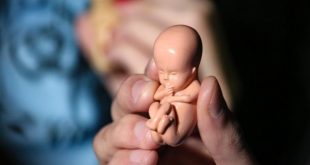 10 علت سقط جنین