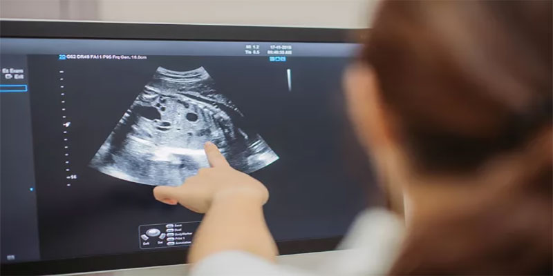 سونوگرافی داپلر از انواع سونوگرافی در بارداری