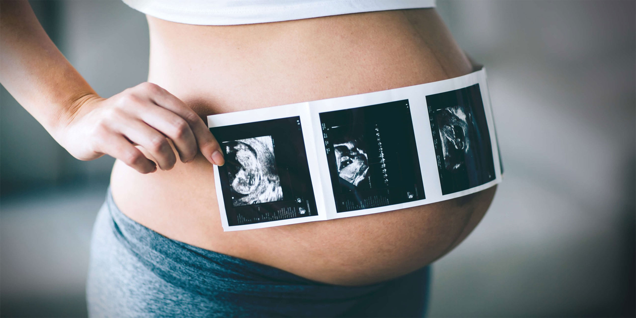 انواع سونوگرافی در بارداری برای سه ماهه دوم