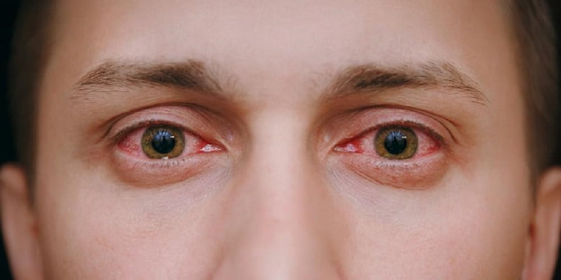 تاثیر مواد مخدر بر قرمزی چشم چگونه است؟
