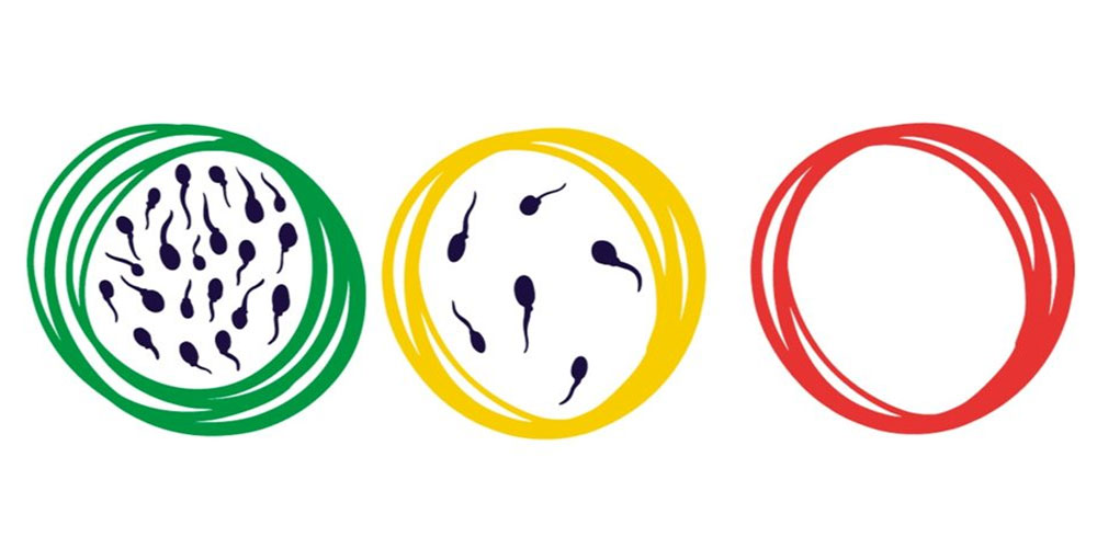 درمان اسپرم صفر در طب اسلامی + علل آن