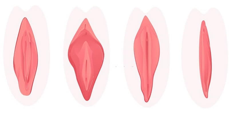 عوارض جراحی زیبایی واژن