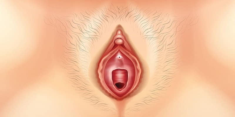 علل انجام جراحی زیبایی واژن (لابیاپلاستی)