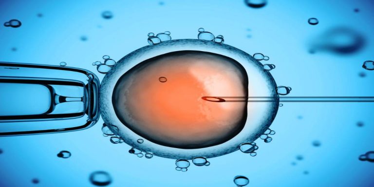 آی وی اف (IVF) چیست؟ + درمان ناباروری توسط آن