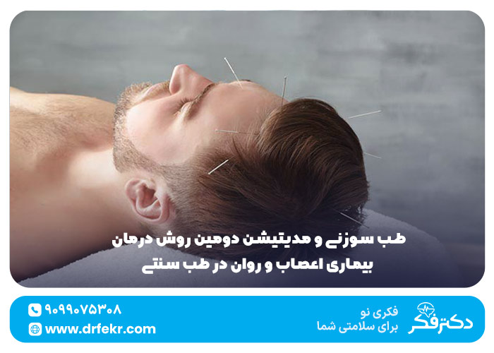 طب سوزنی و مدیتیشن دومین روش درمان بیماری اعصاب و روان در طب سنتی