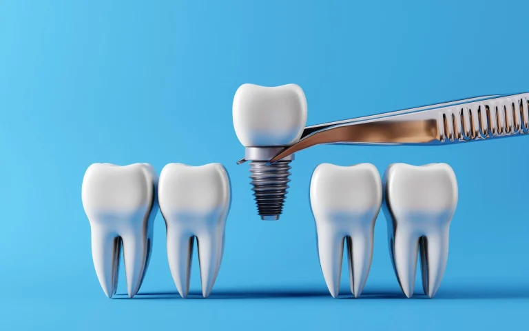 ایمپلنت دندان و افزایش اعتماد به‌ نفس